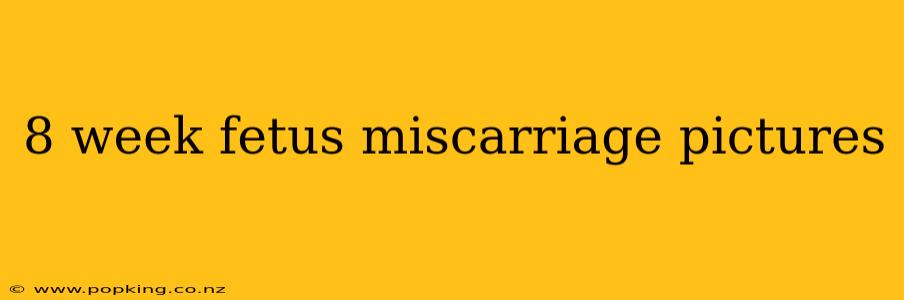 8 week fetus miscarriage pictures