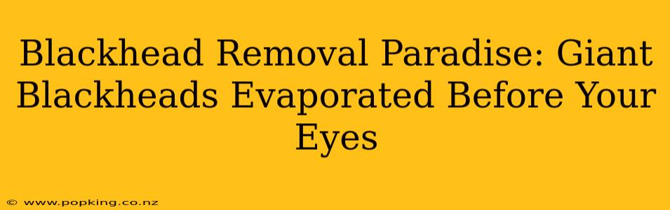 Blackhead Removal Paradise: Giant Blackheads Evaporated Before Your Eyes