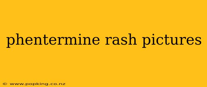 phentermine rash pictures