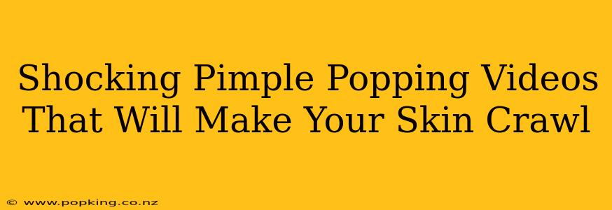 Shocking Pimple Popping Videos That Will Make Your Skin Crawl