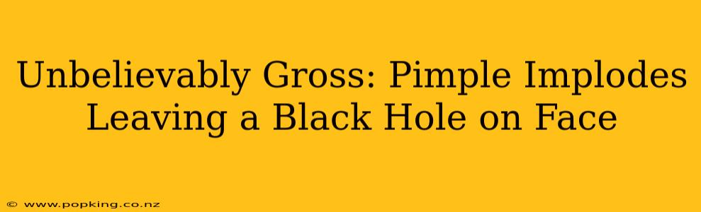 Unbelievably Gross: Pimple Implodes Leaving a Black Hole on Face