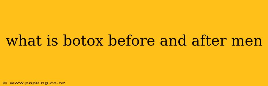 what is botox before and after men