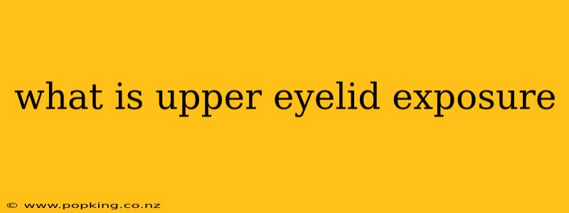 what is upper eyelid exposure