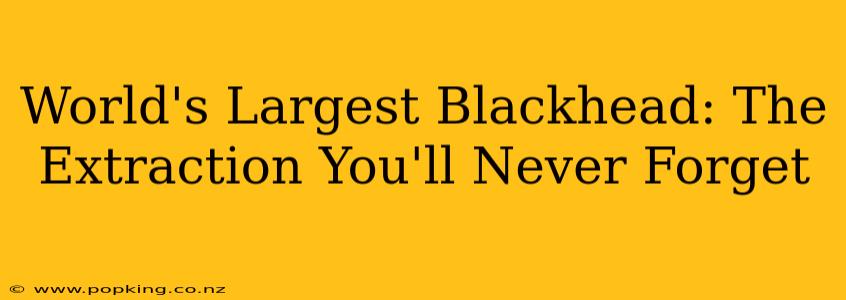 World's Largest Blackhead: The Extraction You'll Never Forget